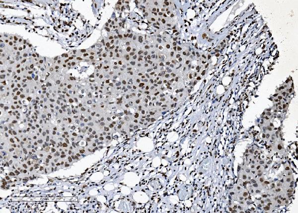 2 - Anti-SAMHD1 Antibody Picoband™ (monoclonal, 3B9) ABO15035