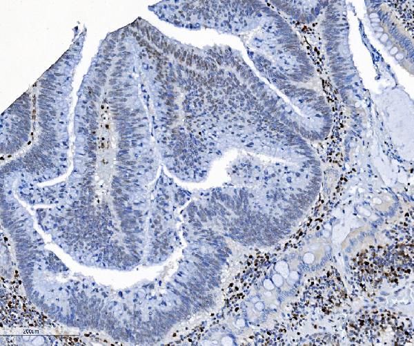 2 - Anti-SAMHD1 Antibody Picoband™ (monoclonal, 3B9) ABO15035