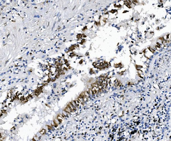 2 - Anti-SAMHD1 Antibody Picoband™ (monoclonal, 3B9) ABO15035
