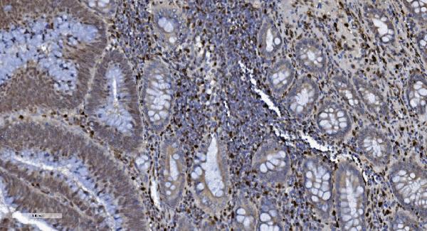2 - Anti-SAMHD1 Antibody Picoband™ (monoclonal, 10H8) ABO15036