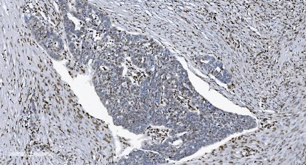 2 - Anti-SAMHD1 Antibody Picoband™ (monoclonal, 10H8) ABO15036