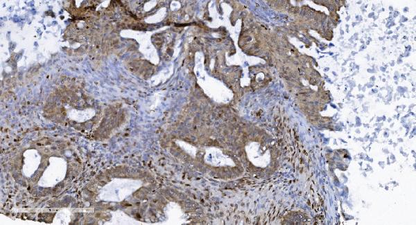 2 - Anti-SAMHD1 Antibody Picoband™ (monoclonal, 10H8) ABO15036