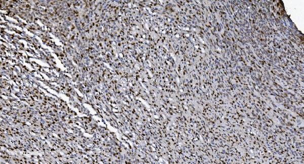 2 - Anti-SAMHD1 Antibody Picoband™ (monoclonal, 10H8) ABO15036