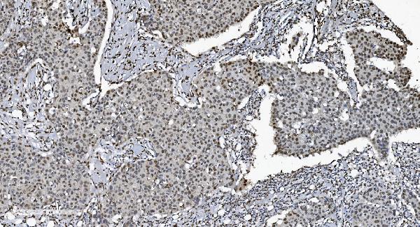 2 - Anti-SAMHD1 Antibody Picoband™ (monoclonal, 10H8) ABO15036