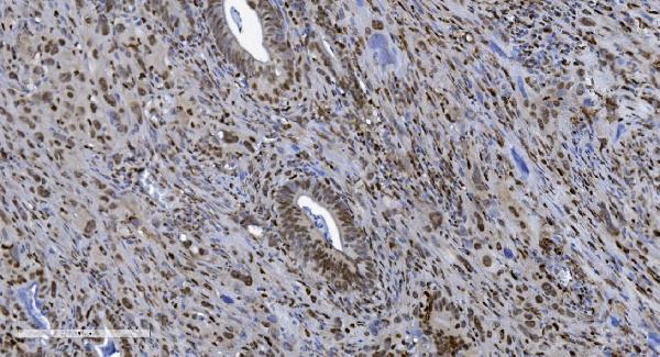 2 - Anti-SAMHD1 Antibody Picoband™ (monoclonal, 10H8) ABO15036