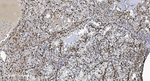 2 - Anti-SAMHD1 Antibody Picoband™ (monoclonal, 10H8) ABO15036
