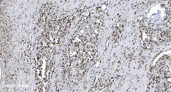 2 - Anti-SAMHD1 Antibody Picoband™ (monoclonal, 10H8) ABO15036