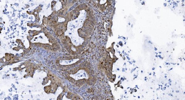 2 - Anti-SAMHD1 Antibody Picoband™ (monoclonal, 10H8) ABO15036