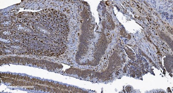 2 - Anti-SAMHD1 Antibody Picoband™ (monoclonal, 10H8) ABO15036