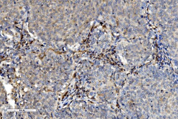 2 - Anti-PNP Antibody Picoband™ (monoclonal, 7G5) ABO15037