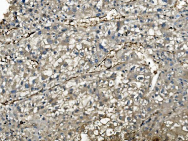 2 - Anti-PNP Antibody Picoband™ (monoclonal, 7G5) ABO15037