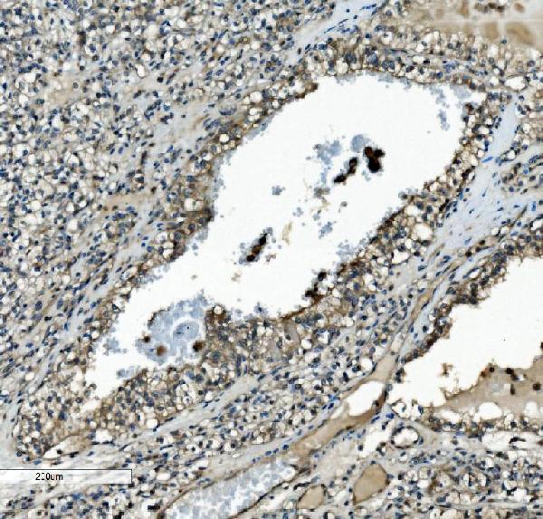 2 - Anti-MEK2/MAP2K2 Antibody Picoband™ (monoclonal, 2H4) ABO15040