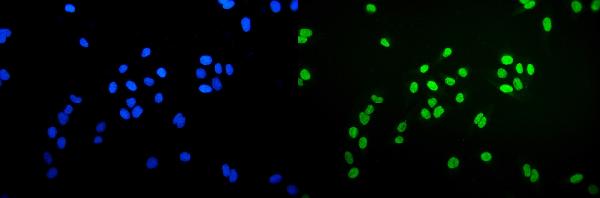 3 - Anti-Ku70 Antibody Picoband™ (monoclonal, 9B6) ABO15042