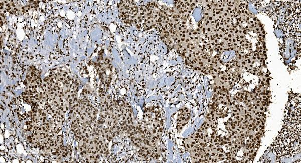 2 - Anti-Ku70 Antibody Picoband™ (monoclonal, 9B6) ABO15042