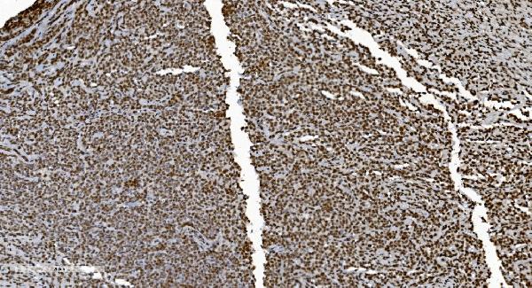 2 - Anti-Ku70 Antibody Picoband™ (monoclonal, 9B6) ABO15042