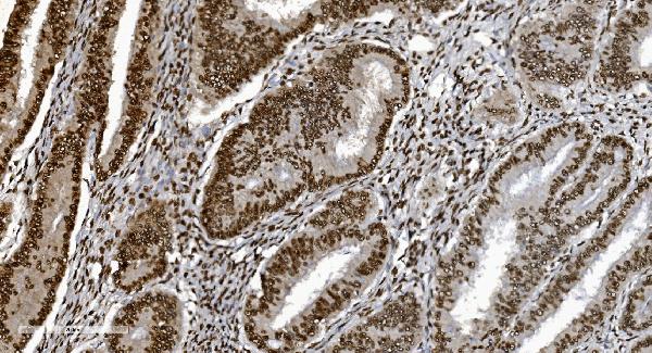 2 - Anti-Ku70 Antibody Picoband™ (monoclonal, 9B6) ABO15042