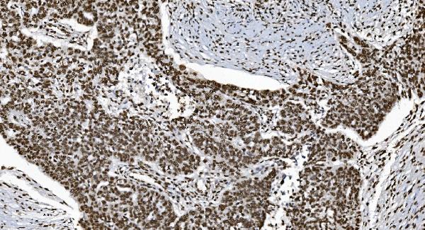 2 - Anti-Ku70 Antibody Picoband™ (monoclonal, 9B6) ABO15042