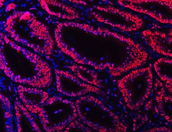 3 - Anti-Ku70 Antibody Picoband™ (monoclonal, 3D7) ABO15043