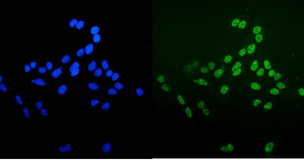 3 - Anti-Ku70 Antibody Picoband™ (monoclonal, 3D7) ABO15043