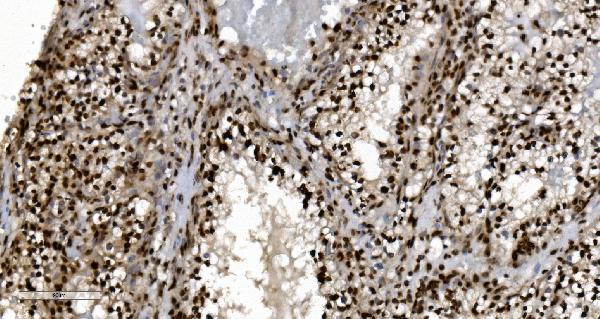 2 - Anti-Ku70 Antibody Picoband™ (monoclonal, 3D7) ABO15043
