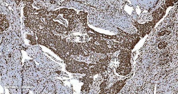 2 - Anti-Ku70 Antibody Picoband™ (monoclonal, 3D7) ABO15043