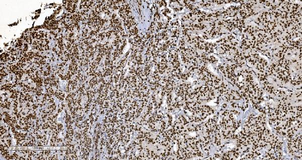 2 - Anti-Ku70 Antibody Picoband™ (monoclonal, 3D7) ABO15043