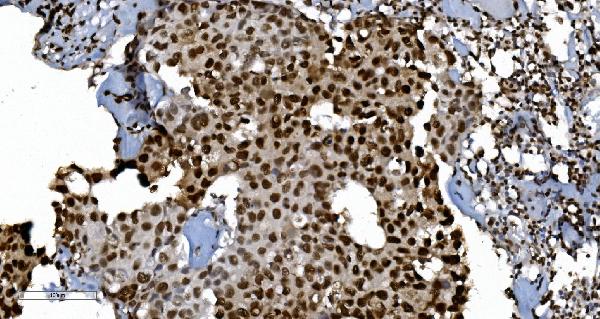 2 - Anti-Ku70 Antibody Picoband™ (monoclonal, 3D7) ABO15043