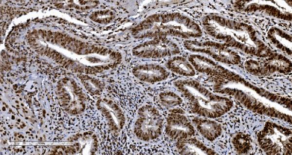 2 - Anti-Ku70 Antibody Picoband™ (monoclonal, 3D7) ABO15043