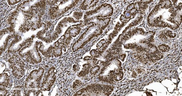 2 - Anti-Ku70 Antibody Picoband™ (monoclonal, 3D7) ABO15043