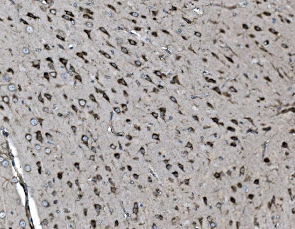 2 - Anti-INPPL1 Antibody Picoband™ (monoclonal, 8C13) ABO15044