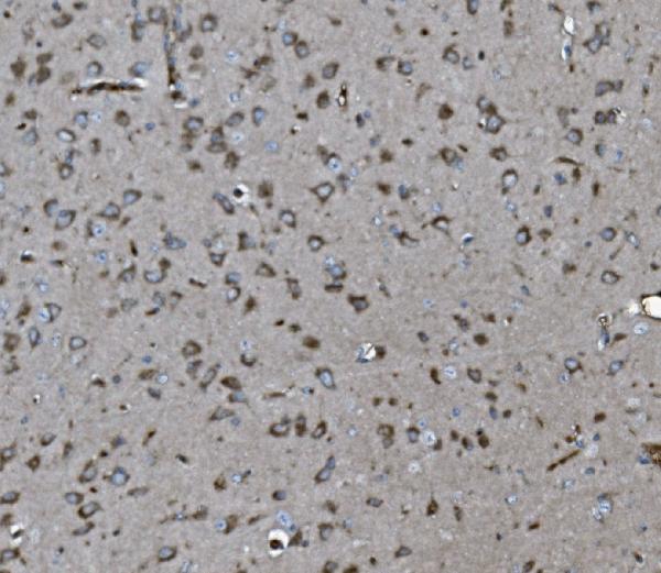2 - Anti-INPPL1 Antibody Picoband™ (monoclonal, 8C13) ABO15044