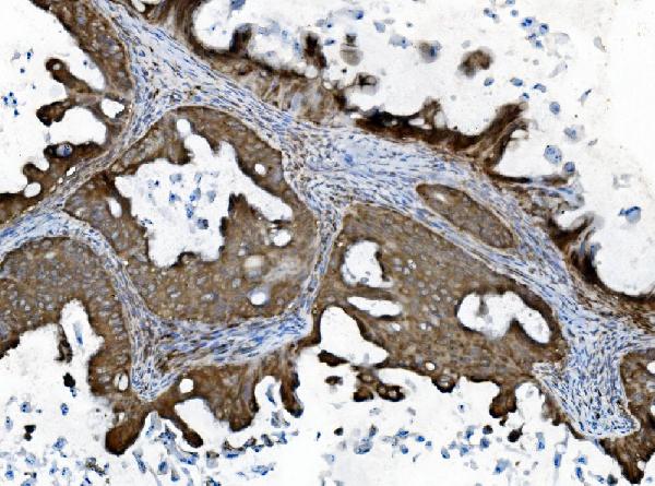 2 - Anti-INPPL1 Antibody Picoband™ (monoclonal, 8C13) ABO15044