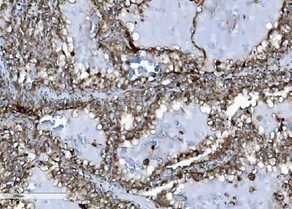 2 - Anti-INPPL1 Antibody Picoband™ (monoclonal, 8C13) ABO15044