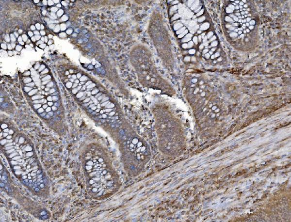 2 - Anti-INPPL1 Antibody Picoband™ (monoclonal, 8C13) ABO15044