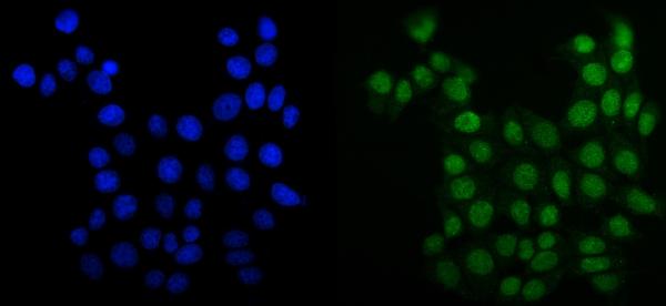 3 - Anti-MCM6 Antibody Picoband™ (monoclonal, 10I9) ABO15045