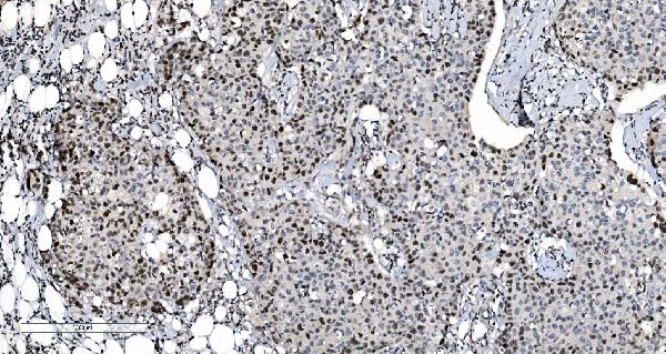 2 - Anti-MCM6 Antibody Picoband™ (monoclonal, 10I9) ABO15045