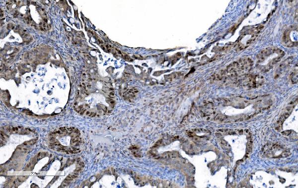 2 - Anti-MCM6 Antibody Picoband™ (monoclonal, 10I9) ABO15045