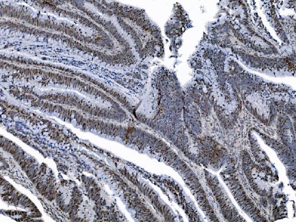 2 - Anti-MCM6 Antibody Picoband™ (monoclonal, 10I9) ABO15045