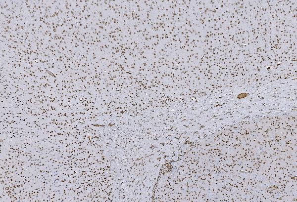 2 - Anti-HP1 alpha/CBX5 Antibody Picoband™ (monoclonal, 8G6) ABO15046