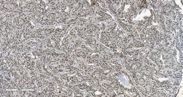 2 - Anti-HP1 alpha/CBX5 Antibody Picoband™ (monoclonal, 8G6) ABO15046