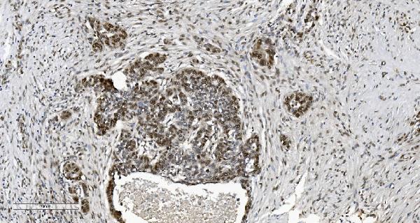 2 - Anti-HP1 alpha/CBX5 Antibody Picoband™ (monoclonal, 8G6) ABO15046