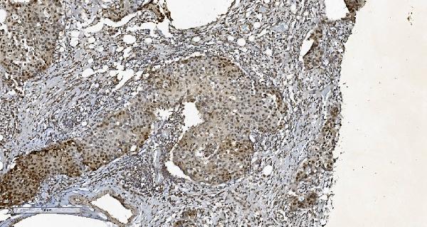 2 - Anti-HP1 alpha/CBX5 Antibody Picoband™ (monoclonal, 8G6) ABO15046