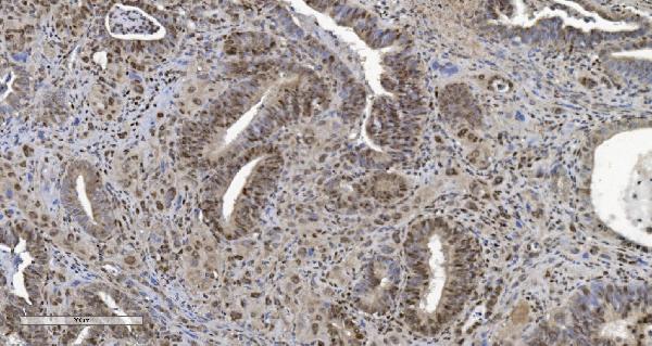 2 - Anti-HP1 alpha/CBX5 Antibody Picoband™ (monoclonal, 8G6) ABO15046