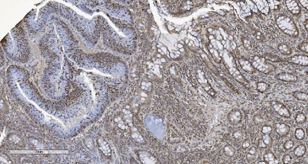 2 - Anti-HP1 alpha/CBX5 Antibody Picoband™ (monoclonal, 8G6) ABO15046
