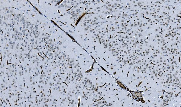 2 - Anti-HP1 alpha/CBX5 Antibody Picoband™ (monoclonal, 8G6) ABO15046