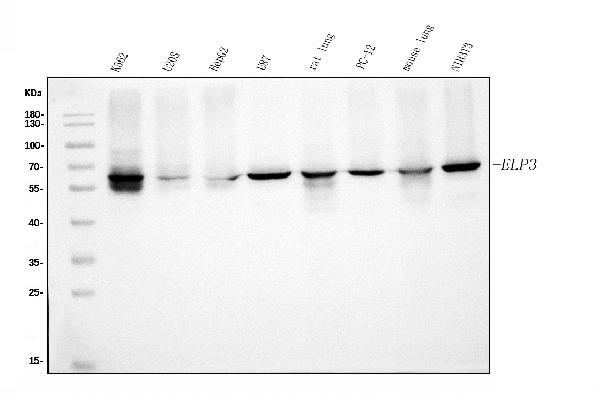 1 - Anti-KAT9/ELP3 Antibody Picoband™ (monoclonal, 8B4) ABO15047
