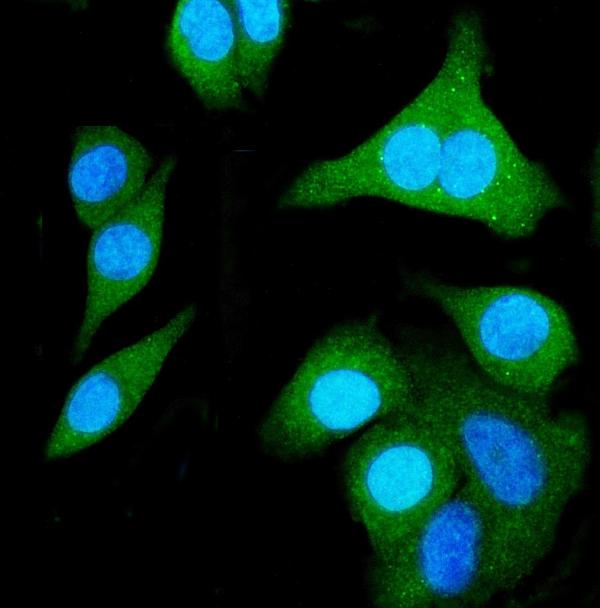 3 - Anti-SHMT1 Antibody Picoband™ (monoclonal, 9C7) ABO15048