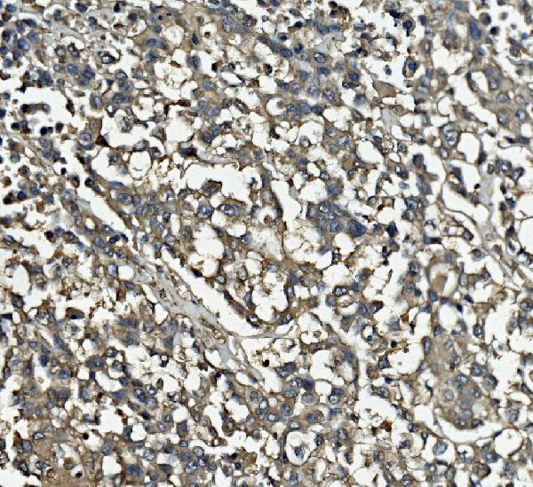 2 - Anti-Clathrin heavy chain/CLTC Antibody Picoband™ (monoclonal, 6D3) ABO15049