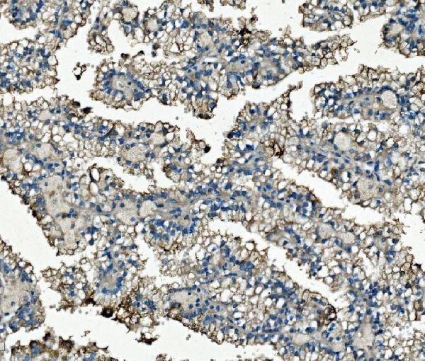 2 - Anti-Clathrin heavy chain/CLTC Antibody Picoband™ (monoclonal, 6D3) ABO15049