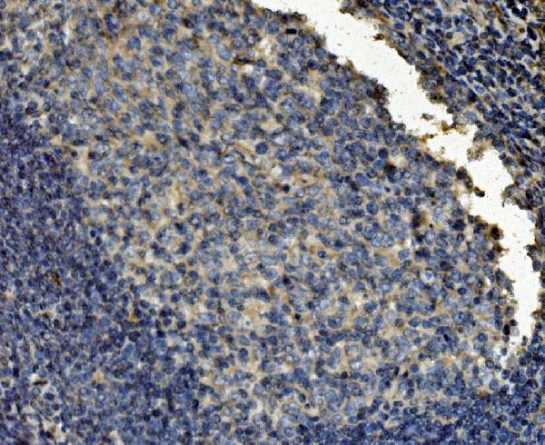 2 - Anti-Clathrin heavy chain/CLTC Antibody Picoband™ (monoclonal, 6D3) ABO15049